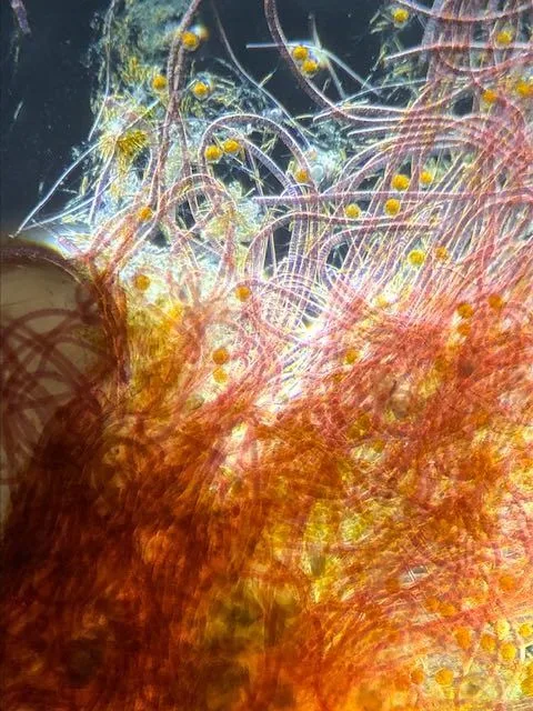 Roze en gele draden van cyanobacteriën onder de microscoop.