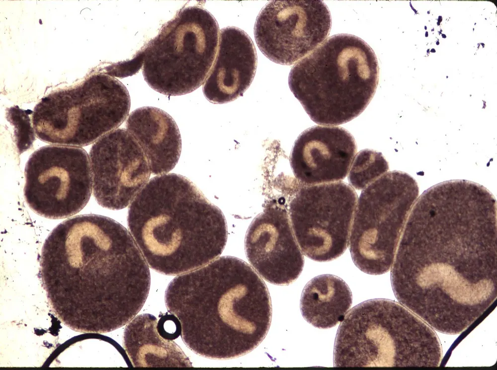 Microscopische opname van volgroeide witte-stipparasieten, met in elk dier de kenmerkende hoefijzervormige kern.